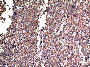 Anti-CCNB1 Monoclonal