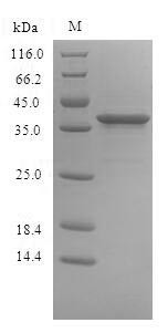 Signal-regulatory protein beta-1 (SIRPB1), partial, human, recombinant