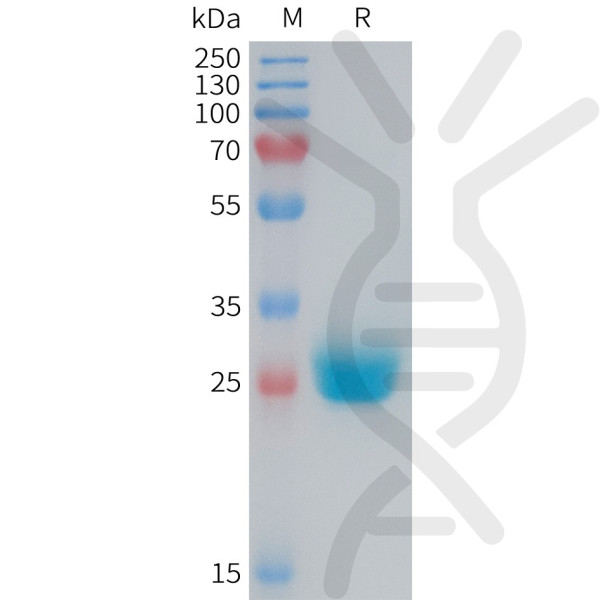 Mouse CXADR Protein, His Tag