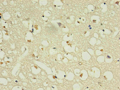 Anti-NPPB Monoclonal, clone 1E1F4