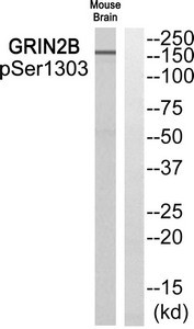 Anti-Phospho-GRIN2B (Ser1303)