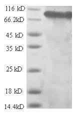 Integrin beta-1 (Itgb1), partial, rat, recombinant