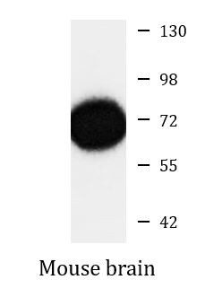 Anti-ATP6V1A