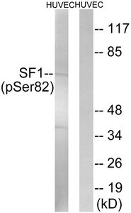 Anti-Phospho-SF1 (Ser82)