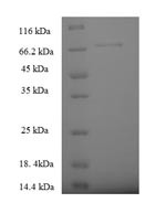 Serine palmitoyltransferase 2 (SPTLC2), partial, human, recombinant