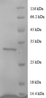 Agouti-related protein (AGRP), partial, human, recombinant