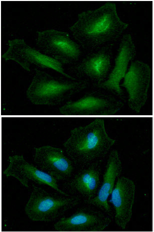 Anti-Glutamine Synthetase, clone 8D7