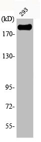 Anti-Phospho-IRS1 (S639)