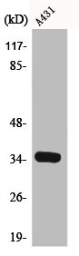 Anti-CDK2