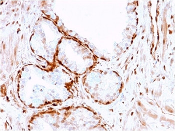 Anti-AKR1B1 / Aldose reductase, clone CPTC-AKR1B1-3