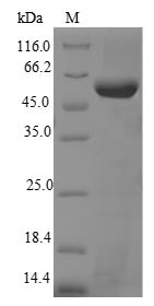 Telomerase reverse transcriptase (Tert), partial, mouse, recombinant