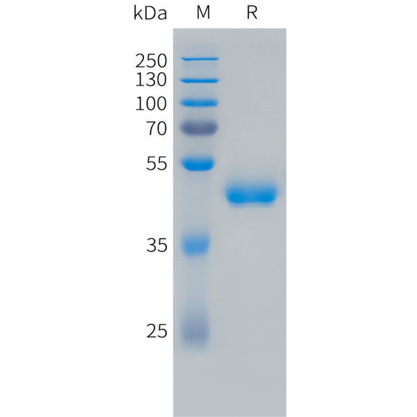 Human VEGF121 Protein, hFc Tag