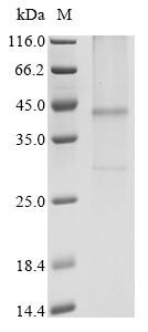 Cysteinyl leukotriene receptor 1 (CYSLTR1), human, recombinant