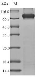 Methylmalonyl-CoA mutase, mitochondrial (MMUT), human, recombinant