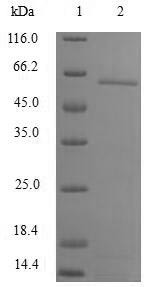 CCR4-NOT transcription complex subunit 8 (CNOT8), human, recombinant