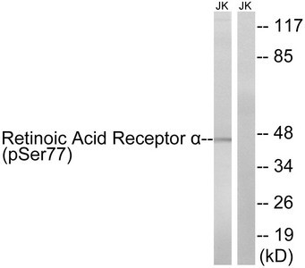 Anti-Phospho-RARA (Ser77)