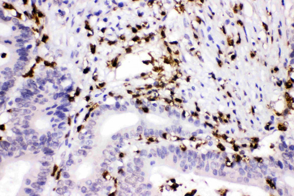 Anti-Cathepsin G