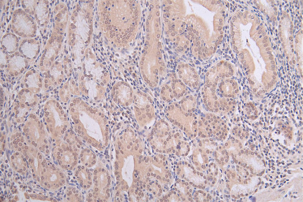 Anti-Mono-methyl-HIST1H3A (K9) Recombinant Monoclonal, clone 13E1