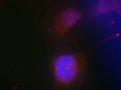 Anti-Phospho-BRCA1 (Ser988)
