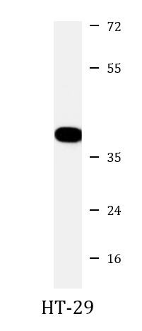 Anti-PPP1CB