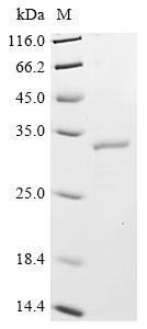 CCR4-NOT transcription complex subunit 7 (CNOT7), human, recombinant