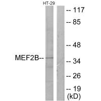 Anti-MEF2B