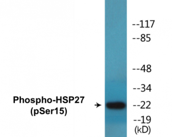 HSP27 (Phospho-Ser15) Colorimetric Cell-Based ELISA Kit