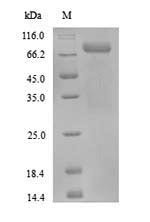 Protein-arginine deiminase type-3 (PADI3), human, recombinant