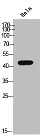 Anti-Phospho-CSNK2A1 (Y255)