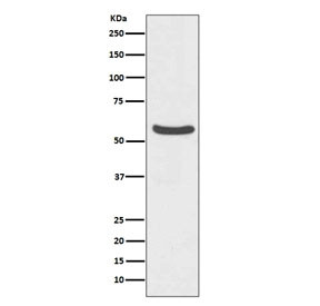 Anti-GLUT2 / SLC2A2, clone GGI-19