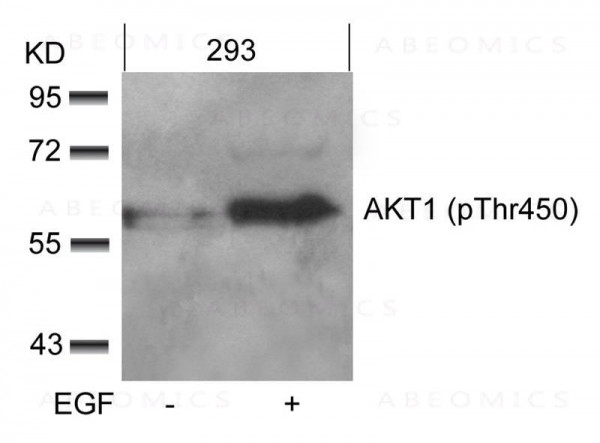Anti-AKT1 (phospho-Thr450)