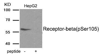 Anti-Phospho-ESR2 (Ser105)