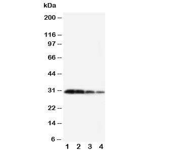 Anti-Kallikrein 1