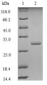 Glucagon-like peptide 1 receptor (Glp1r), partial, mouse, recombinant