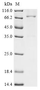 Myeloblastin (PRTN3), Biotinylated, human, recombinant