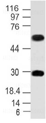 Anti-MITF (Clone: ABM1H91)