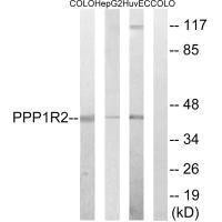 Anti-PPP1R2 (Ab-44)