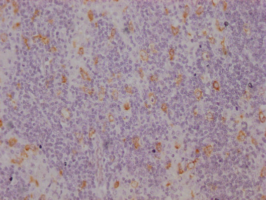 Anti-CD163 Monoclonal