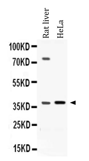Anti-AKR1C1 + AKR1C2
