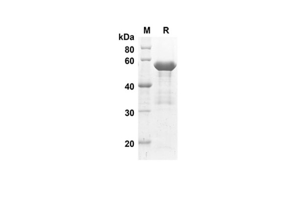 ACE2 Protein (Sumo Tag) (recombinant human)