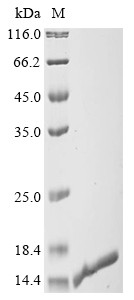 Apoptosis-associated speck-like protein containing a CARD (PYCARD), partial, human, recombinant