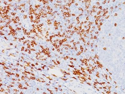 Anti-CD8A (Cytotoxic- &amp; Suppressor T-Cell Marker)(Clone: SPM548)