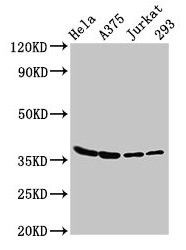 Anti-LDHA