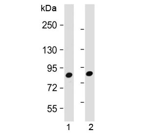 Anti-MUT / Methylmalonyl-CoA mutase