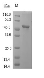 L-lactate dehydrogenase C chain (LDHC), human, recombinant