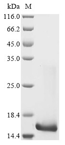 Interleukin-21 (IL21), partial, human, recombinant