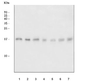 Anti-Adipocyte acid phosphatase / ACP1