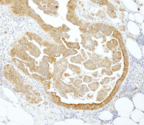 Anti-PABP4 (IHC)