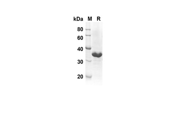 IL-21 Protein (Trx Tag) (recombinant rat)