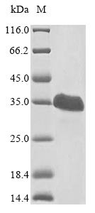 Von Hippel-Lindau disease tumor suppressor (VHL), human, recombinant